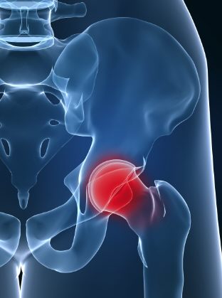 hip joint-Norman Marcus Pain Institute blog